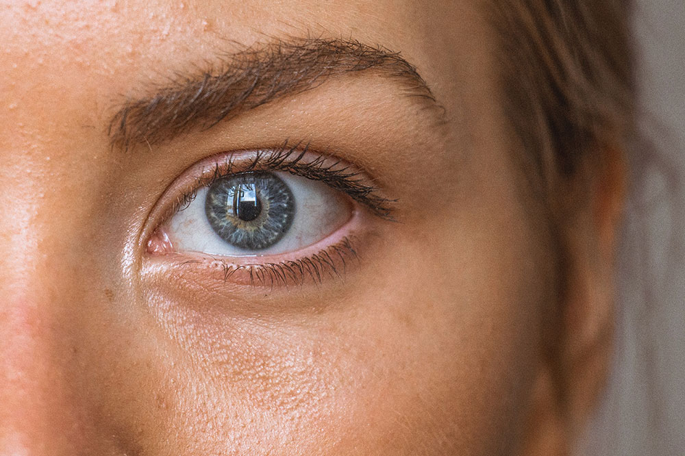 5 Common Eye Conditions and Their Causes