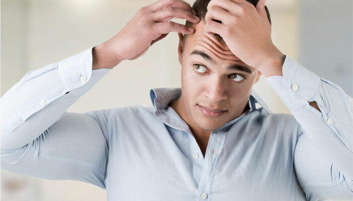 Main Causes of Male Pattern Baldness