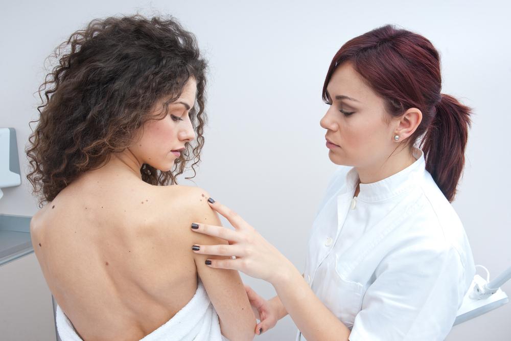 Common Early Warning Signs of Melanoma